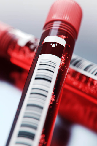 autoanalisi-sangue-farmacia-sarteschi